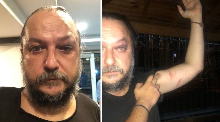 Birgün yazarı Dağüstün saldırıya uğradı