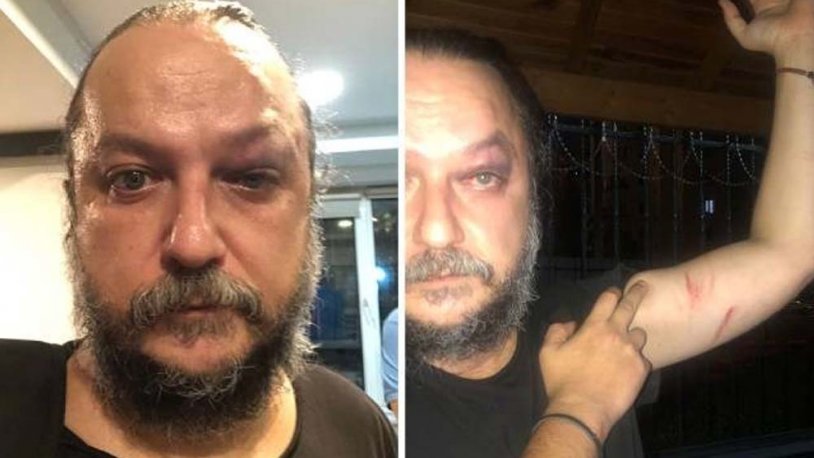Güvenç Dağüstün’e saldıran 2 kişi serbest bırakıldı