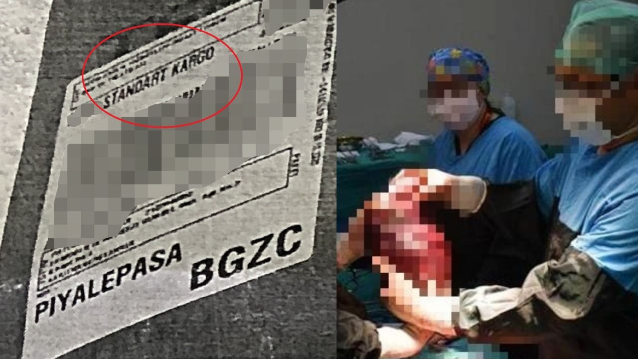 2021 Türkiye'si... Standart kargoyu seçmişler! Çekilen anons aynen şu şekilde: "Kargoda bir adet insan dalağı kaybolmuştur"