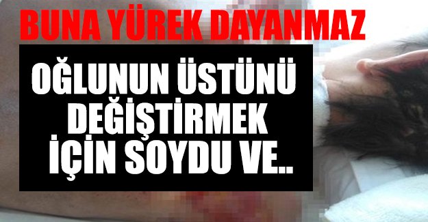 Hastanede 66 günde sırtı bu hale geldi