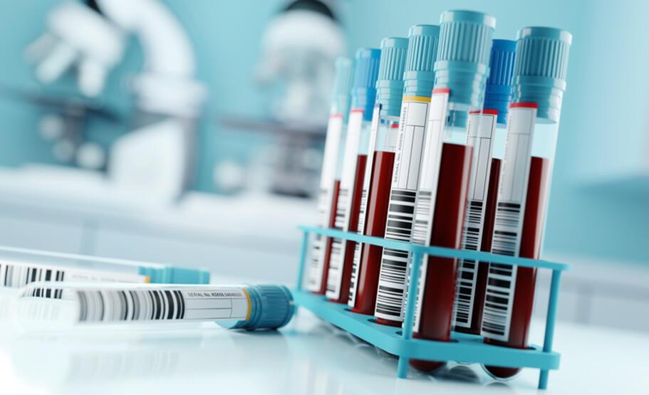 İlk kez HIV pozitif bir kadın virüsten tamamen kurtuldu