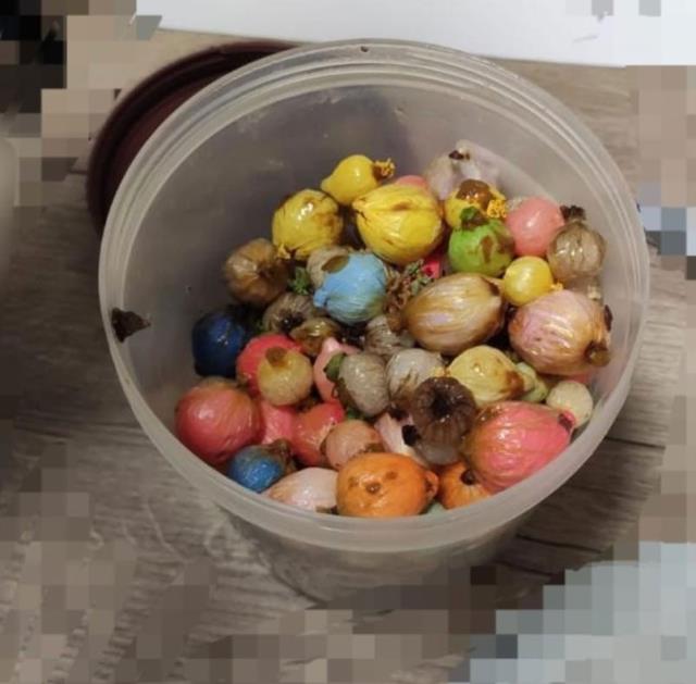 Otel odasında ölü bulunmuştu! Midesinden bakın ne çıktı