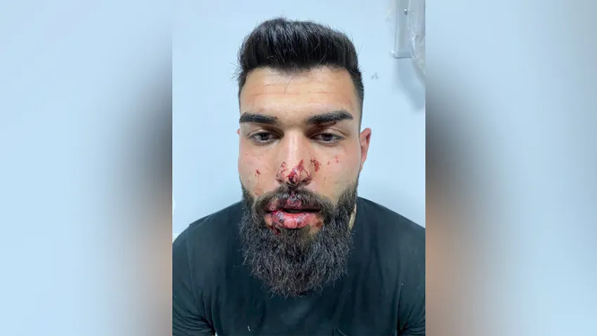 Gözaltında darp edilen Gül: 'Pardon, sen değilmişsin, şikayetçi olma' dediler