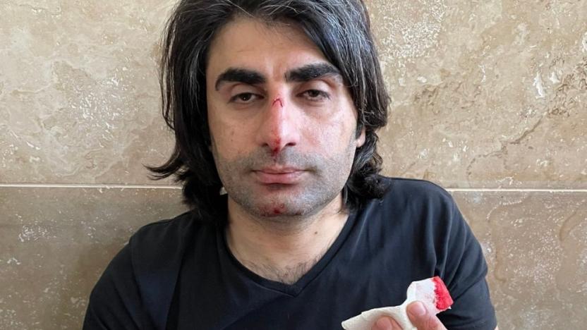 Polis gözaltına aldığı kişiyi darp etti, kendisini uyaran avukata kafa attı