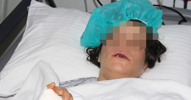 İşte levyeyle dövüp, kerpetenle dişlerini sökmenin bedeli!