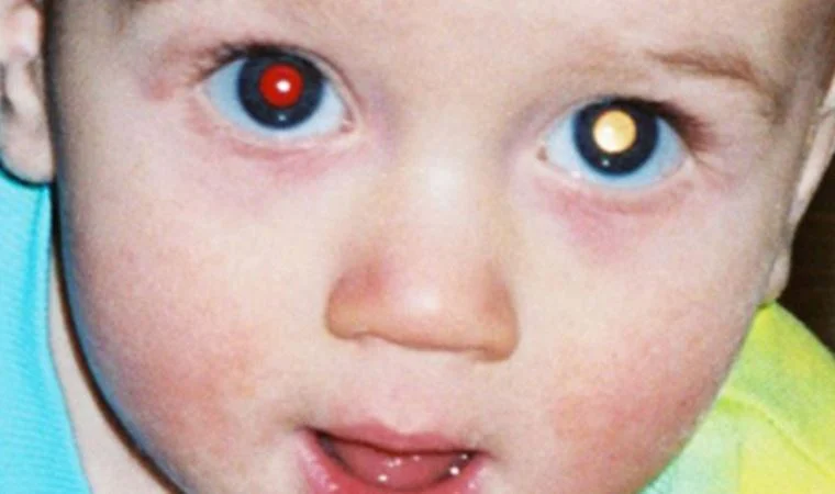 Fotoğraflarda ortaya çıkıyor! Böyle görünüyorsa kanser habercisi
