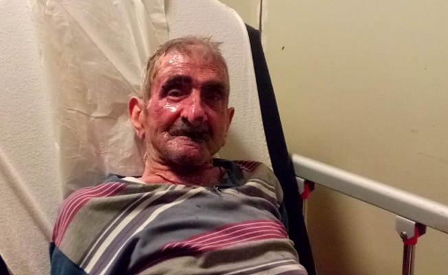 Oksijen maskesi ile sigara içen 'çılgın Türk' bu hale geldi