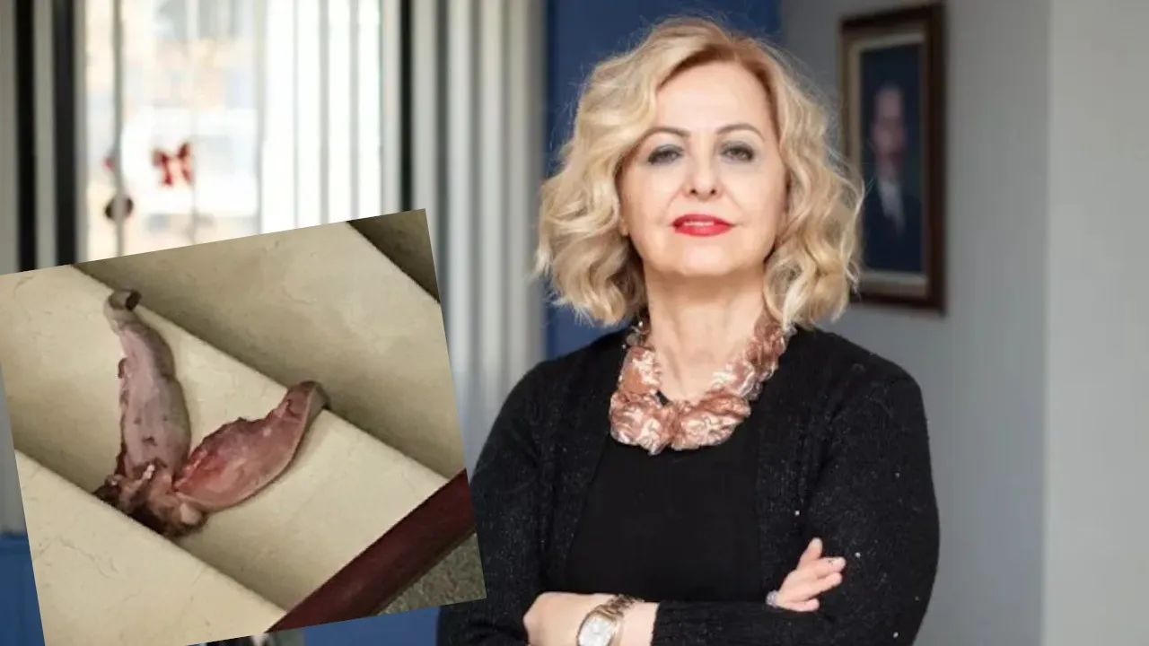 Dana dili ile tehdit edilmişti! TTB Şenol için harekete geçti...