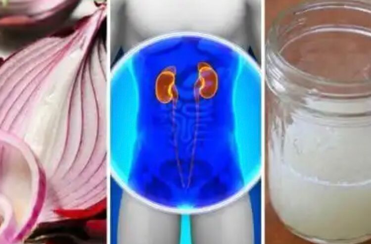 Böbrekler nasıl temizlenir? İşte soğan kürü mucizesi...
