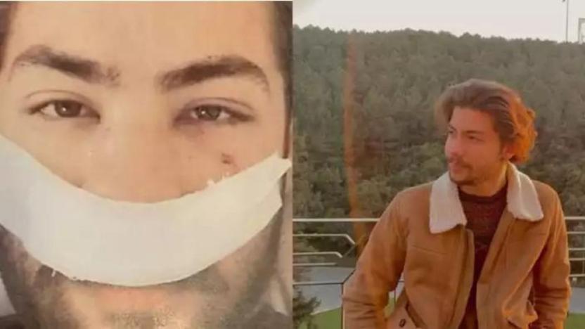 'İstek parçamı niye değiştirdin' deyip burnunu kırdı