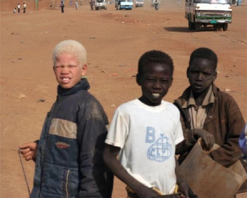 Mozambik'te albino erkekleri yiyorlar