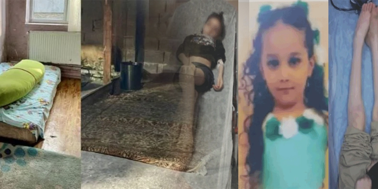 6 yaşındaki çocuk yetersiz beslenme ve bakımsızlık yüzünden öldü! Aile Bakanlığı, geride kalan 2 kardeş için devreye girdi