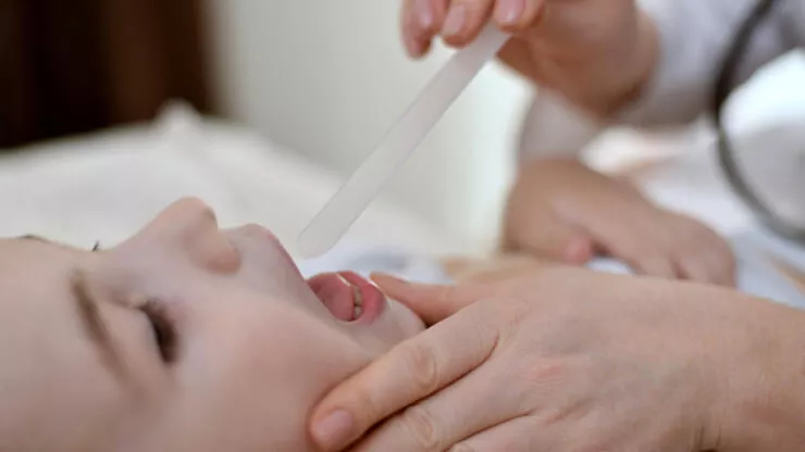 Strep A nedir, belirtileri nelerdir? Nasıl bulaşır? Ölümcül müdür?