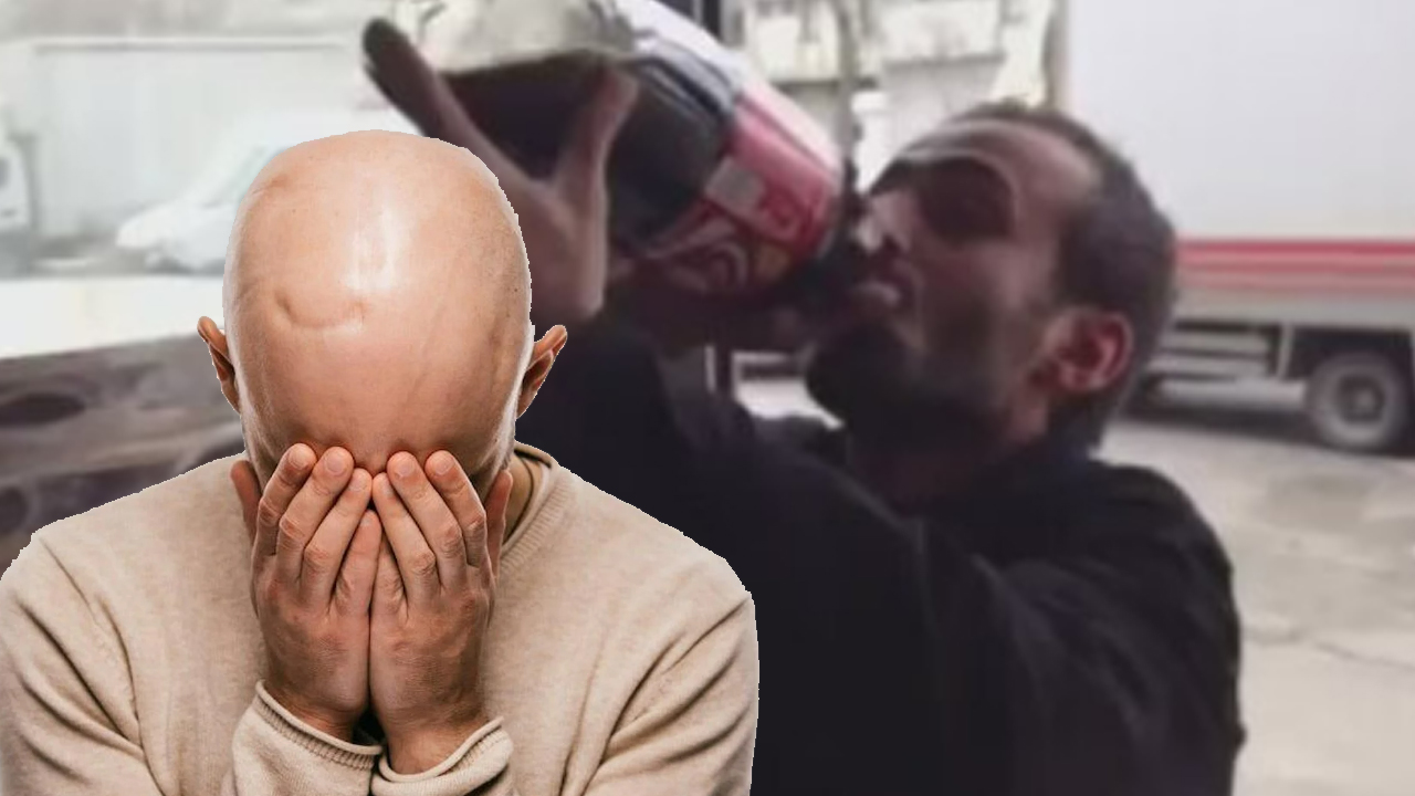 Kel kalmak istemiyorsanız koladan uzak durun!