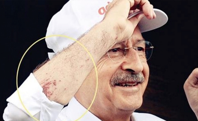Yarasına aldırmadan yürüyor