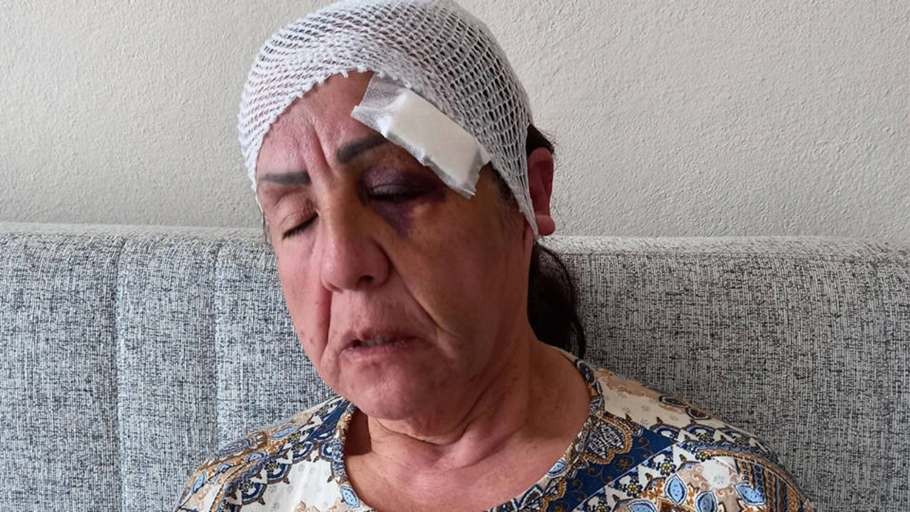 AKP'li adayın babasından bir kadına keserle saldırı