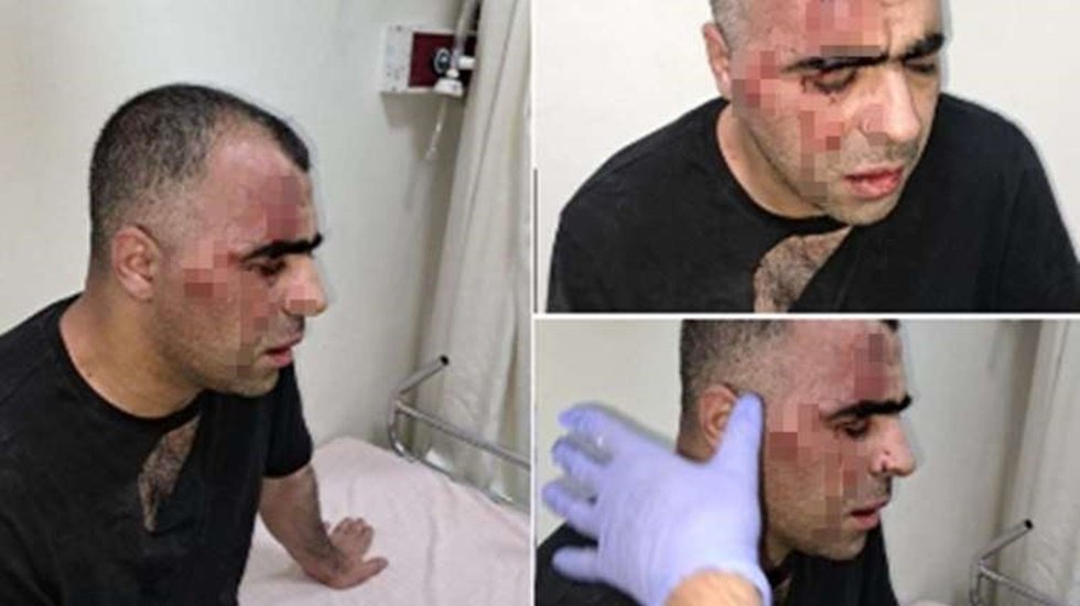 Saldırıya uğrayan gazeteci Sinan Aygül yeniden hastaneye kaldırıldı