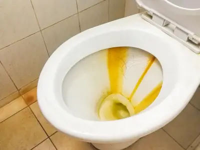 Tuvalette oluşan sarı lekeler nasıl yok edilir? İşte sararmış tuvaleti temizlemenin basit yolu