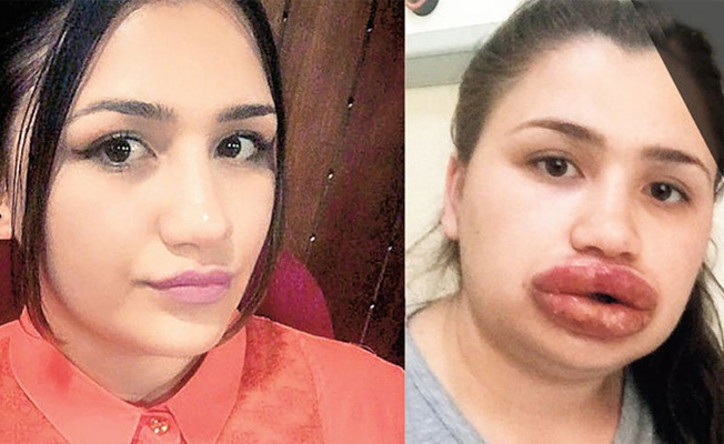 Sahte estetikçi, mağdur hemşireyi suçladı