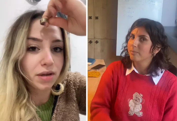 Altın yüzükle demir eksikliği testi gerçek mi? Yüzde bıraktığı siyah lekenin sebebi belli oldu