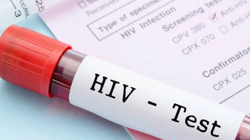 HIV tedavisinde umut vadeden yeni gelişme