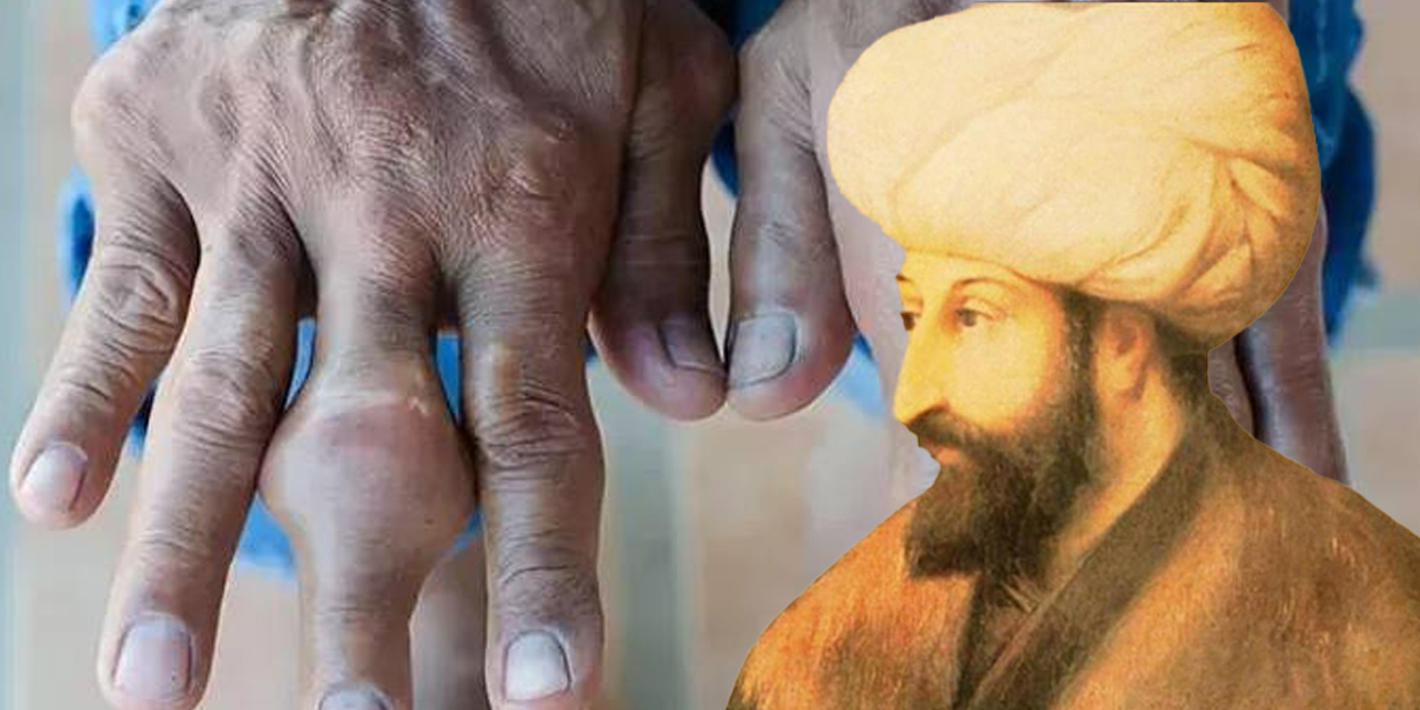 Fatih Sultan Mehmet'i yatağa düşüren hastalık tekrar hortladı!