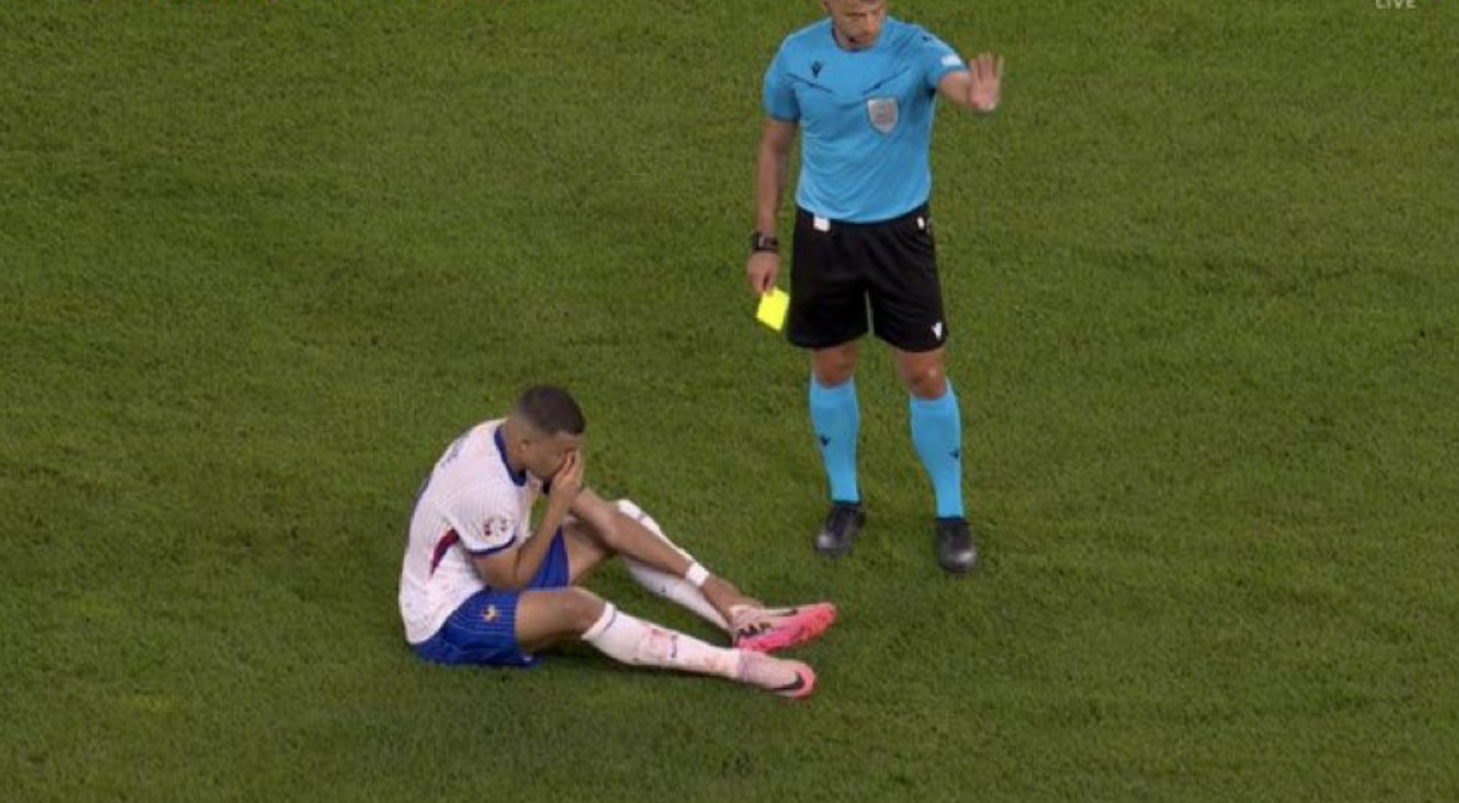 Mbappe maçta kanlar içinde yerde kaldı