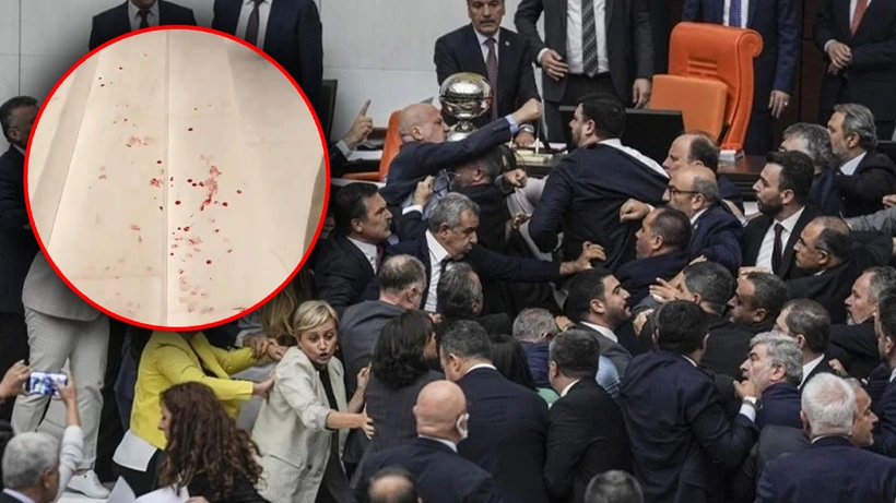 Meclis'teki kavgalar için garip önlem! O merdivenlerin sert zeminlerindeki sivrilikler düzeltilecek
