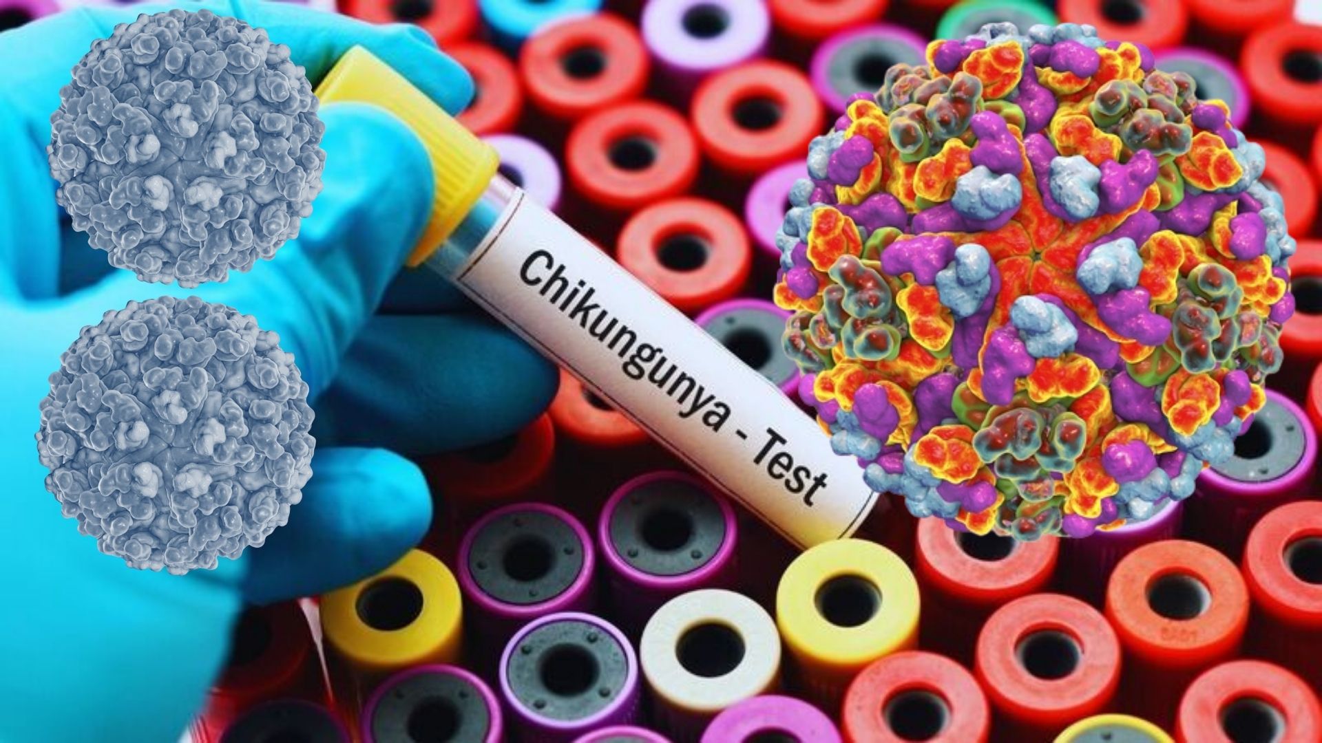 Yine Çin'de başladı: DSÖ'den yeni virüs uyarısı!