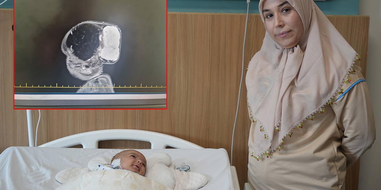 Dünyada nadir görülüyor! Minik Talha’nın kafasındaki 'dev' kitle 4 saatte çıkarıldı