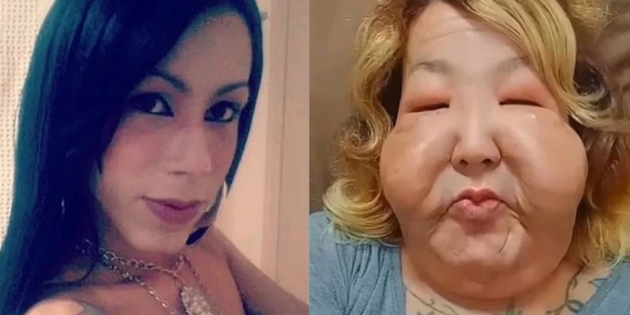 Dolgu yaptırmak istedi, hayatı karardı: Madeni yağ çıktı