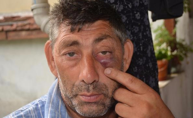 Zihinsel engelliye darp iddiası!
