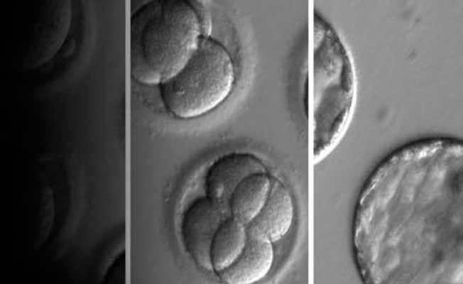 Bilim dünyasında bir ilk: Kalp hastalığına 'genetik tamir' tedavisi