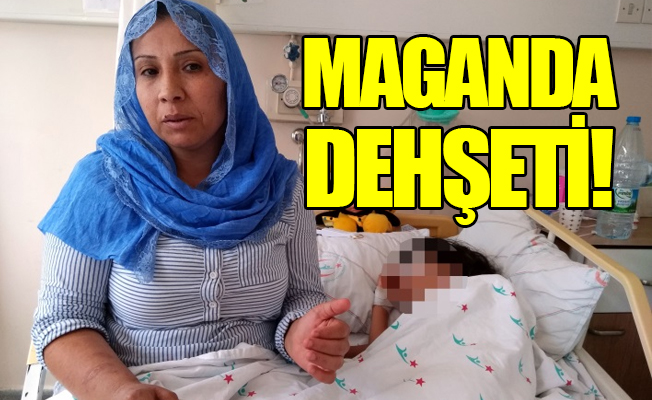 İstanbul'da dehşet: Bu çocuk gözünü kaybedebilir!