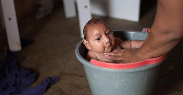 Zika insanların maruz kaldığı en kötü virüs olabilir