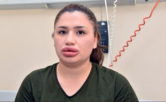 Üst düzey mahkemeden flaş karar! Sahte estetikçinin tahliyesine itiraz reddedildi!