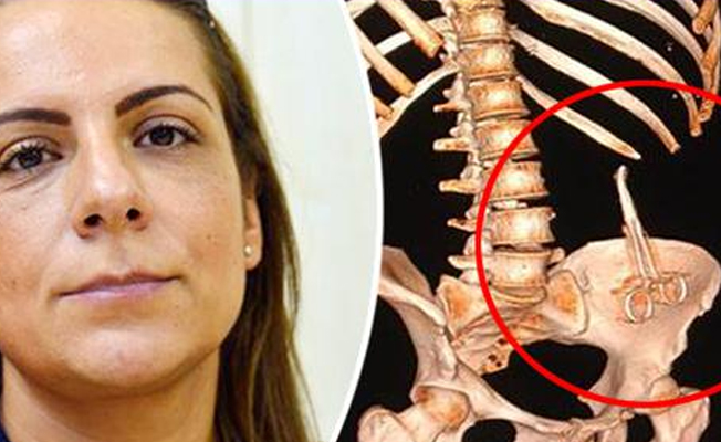 Türkiye'de ameliyat oldu, Alman doktor fark etti