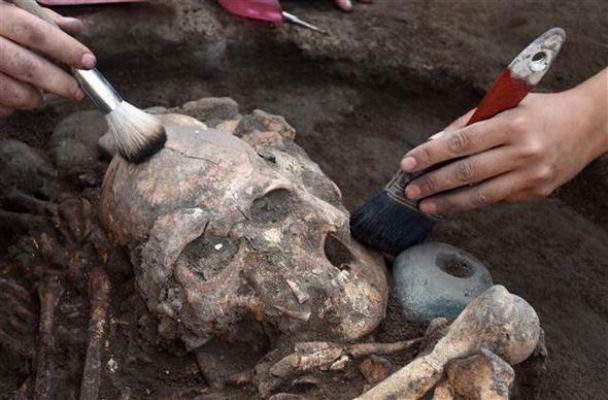 Dünya tarihinde bir ilk Diyarbakır'da gerçekleşti