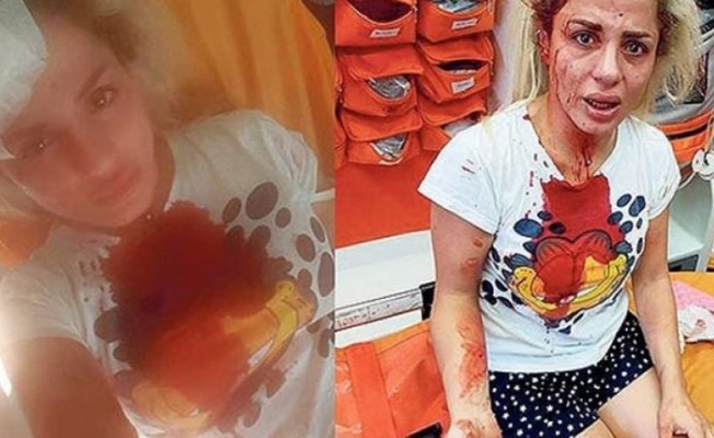 Sokak ortasında önce taciz etti ardından dövdü…