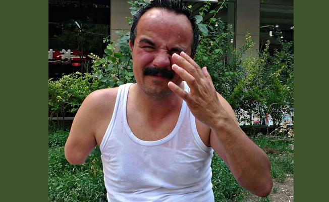 Veli Saçılık: Biz atletle adalet için direnmeyi iyi biliriz!