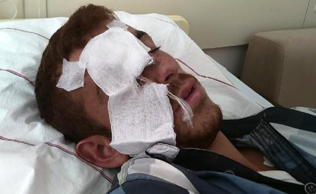 İnşaat çivisi gözünü delip, beynine saplandı