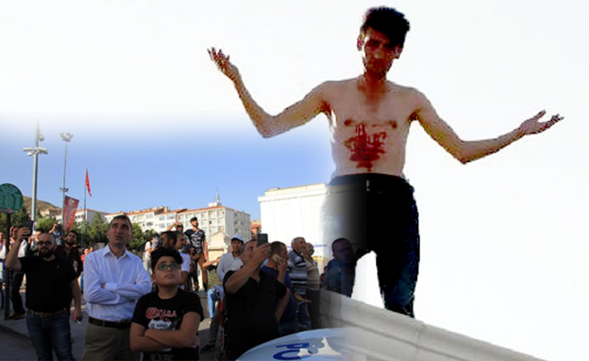 Yol parası bulamayınca intihar girişiminde bulundu