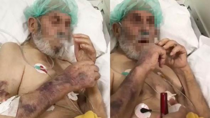 Skandal görüntüler! Hemşireler yaşlı adama bunu da yaptı