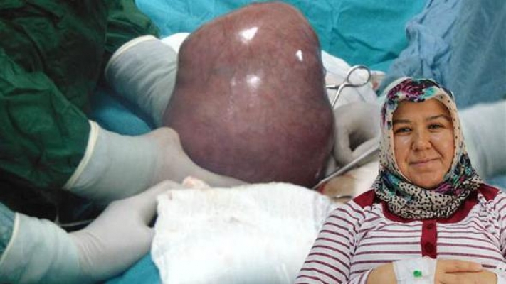 Karnım ağırıyor dedi, rahminden çıkan şoke etti!