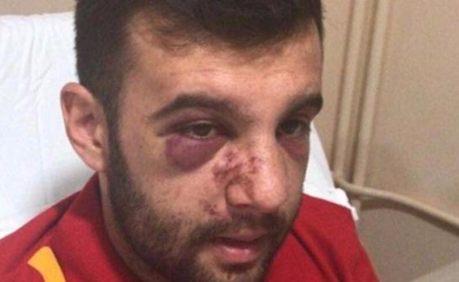 Bir Galatasaray taraftarının daha darp edildiği ortaya çıktı... Üniversite öğrencisi darp edildi