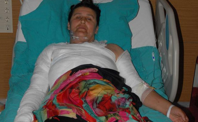 Dedikodu yaptığını iddia ettiği komşusunu kaynar suyla haşladı