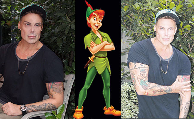 Estetikle hayallerine kavuşuyor: Hırvat Peter Pan Neverland’ını Türkiye’de buldu