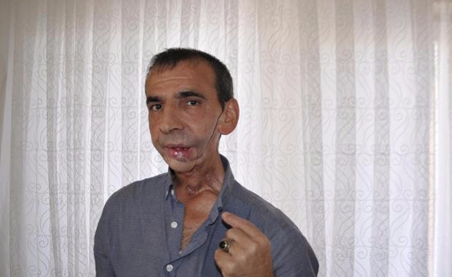 Diş ağrısıyla hastaneye başvurdu, çenesini aldılar...