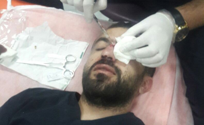 Hasta yakını, hemşirenin burnunu kırdı!