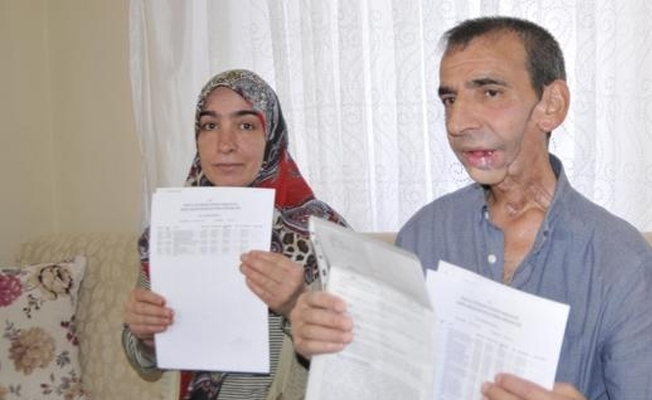 Yanlış teşhis konulup çenesi alındı